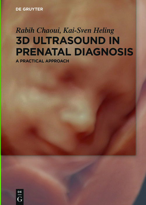 Cover 3D Ultrasound in Prenatal Diagnosis