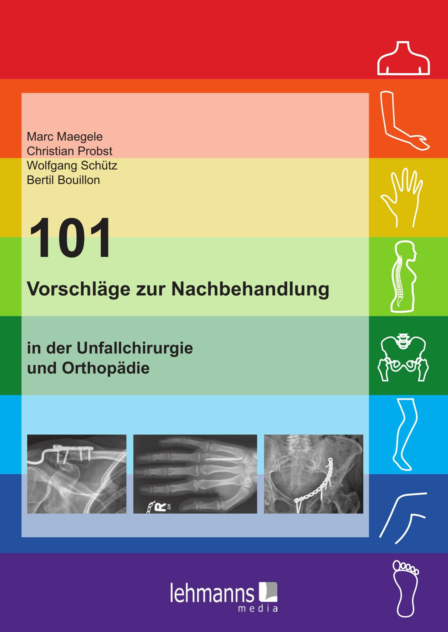 Cover 101 Vorschläge zur Nachbehandlung