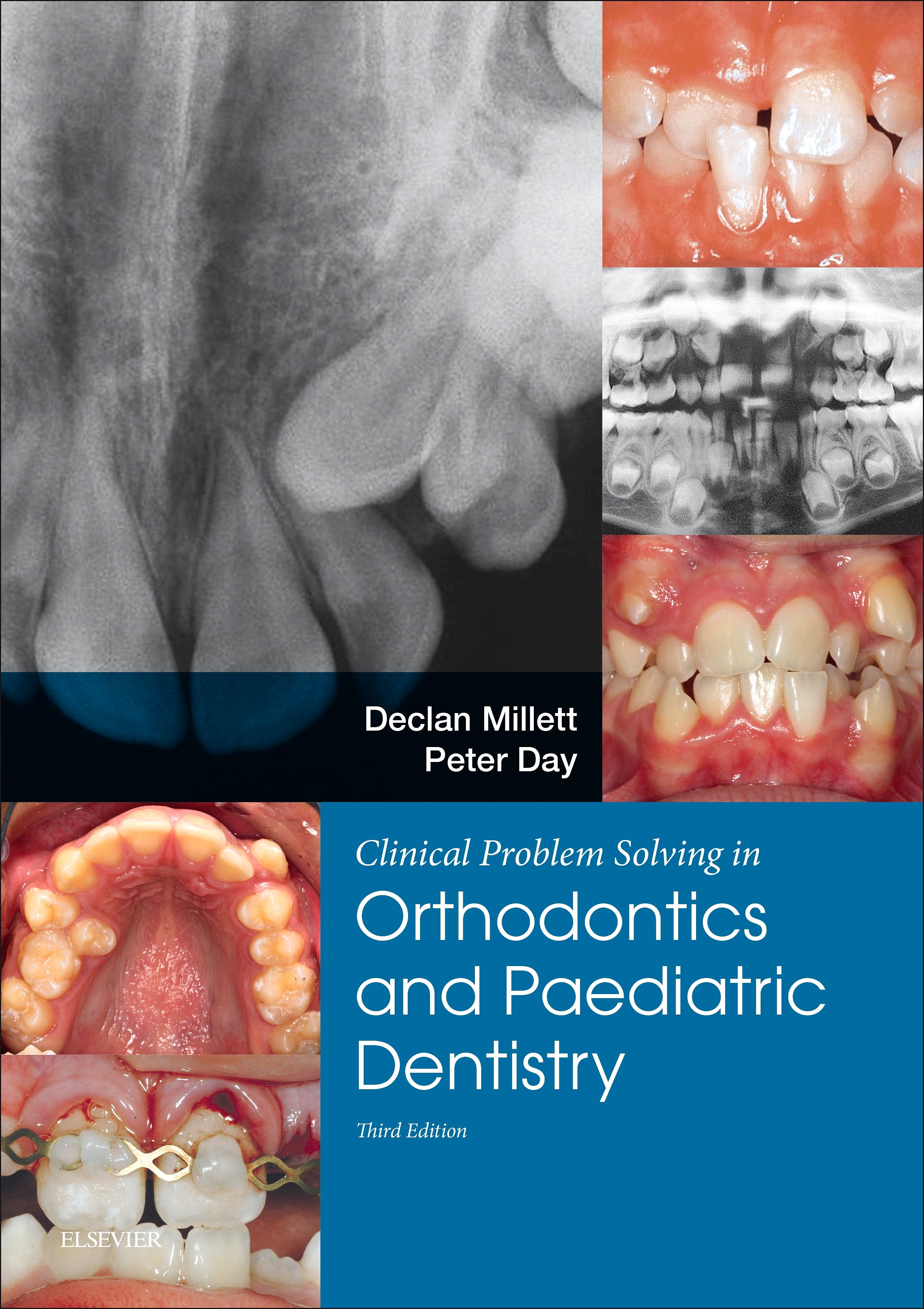 clinical problem solving in dentistry orthodontics and paediatric dentistry