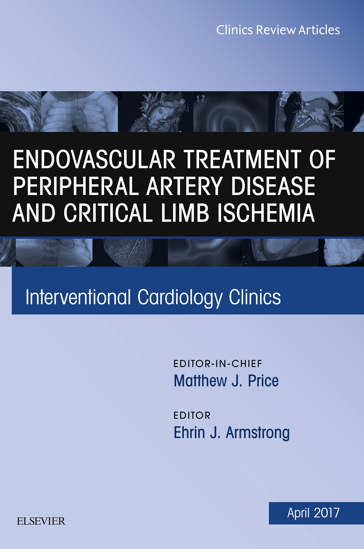 Endovascular Treatment Of Peripheral Artery Disease And Critical Limb ...