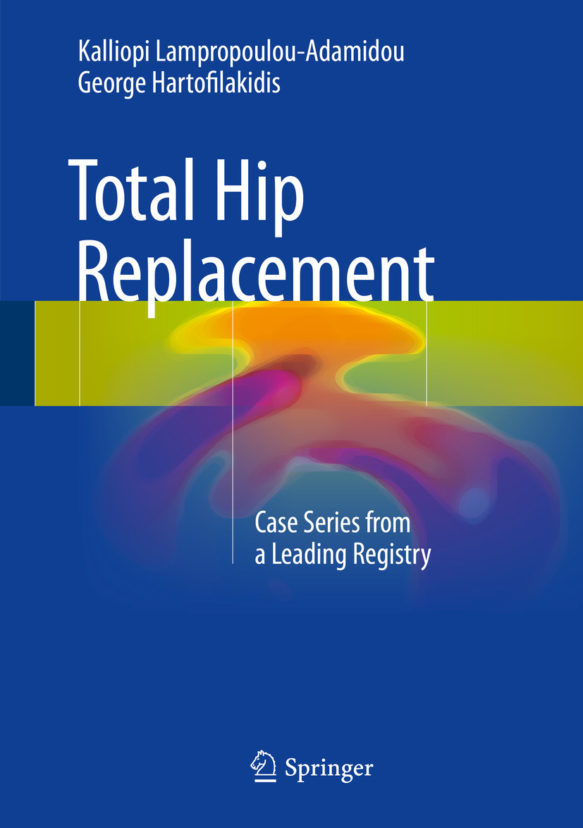 Total Hip Replacement EBook frohberg