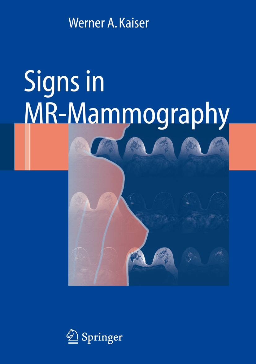 Signs in MR-Mammography