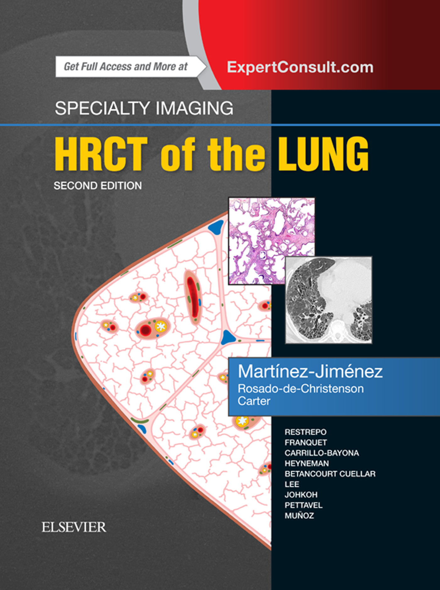 Cover Specialty Imaging: HRCT of the Lung E-Book
