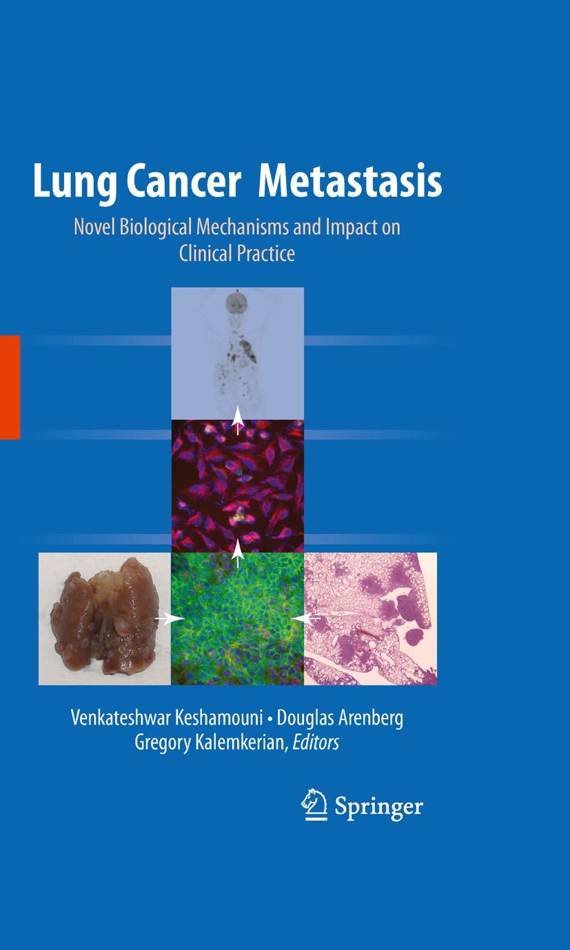 lung-cancer-metastasis-e-book-frohberg