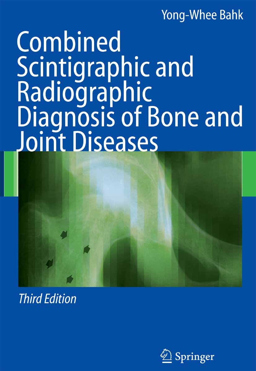 Cover Combined Scintigraphic and Radiographic Diagnosis of Bone and Joint Diseases