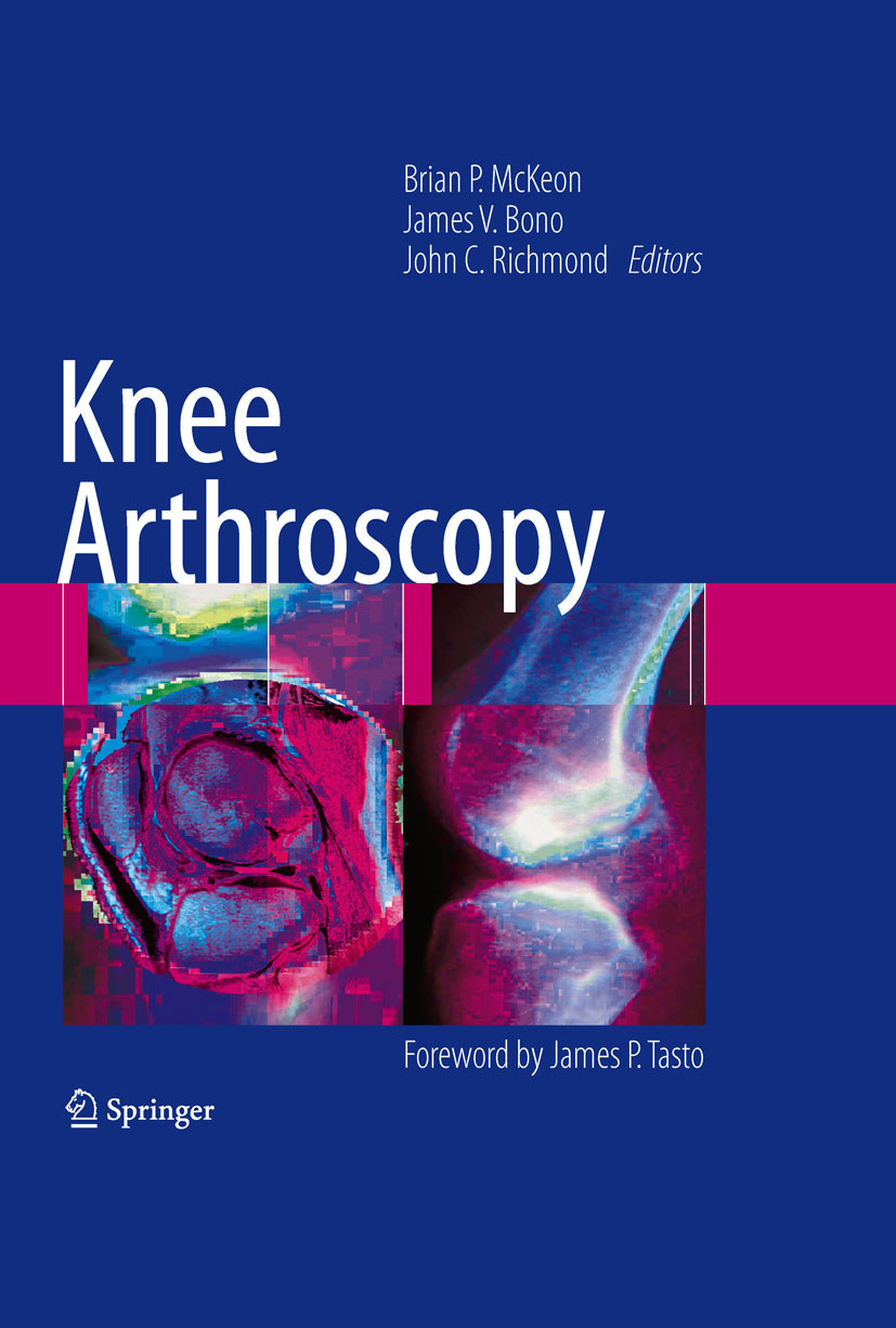 Knee Arthroscopy