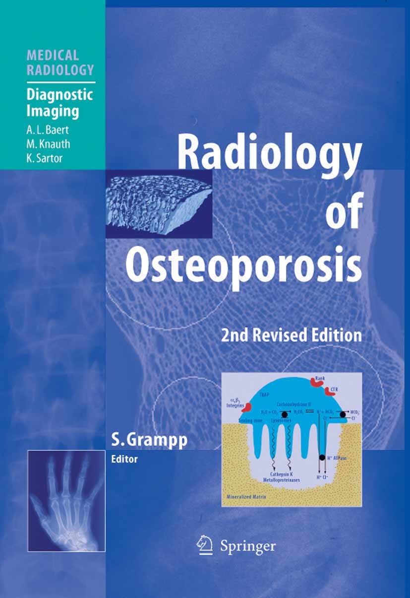 Cover Radiology of Osteoporosis