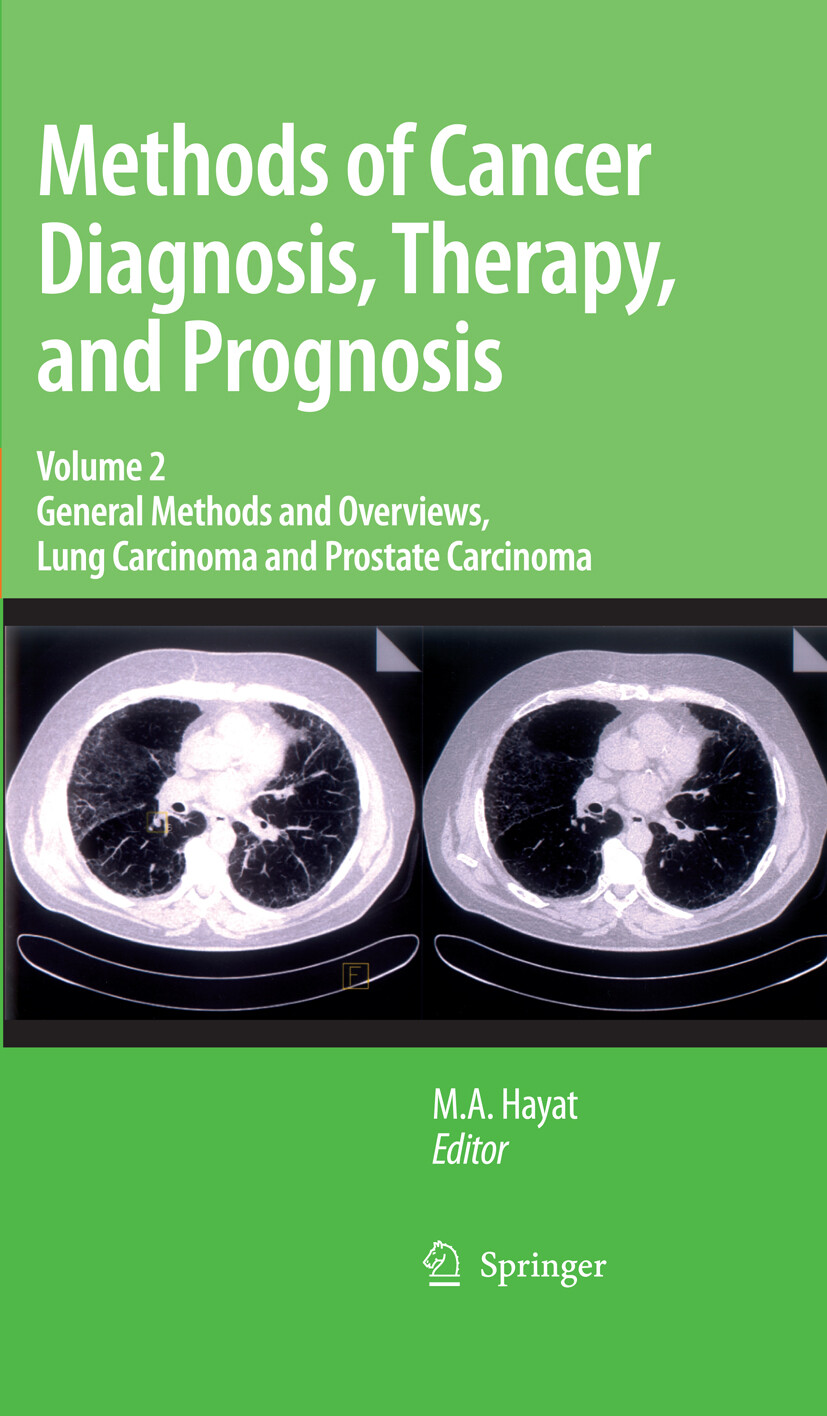 Cover Methods of Cancer Diagnosis, Therapy and Prognosis