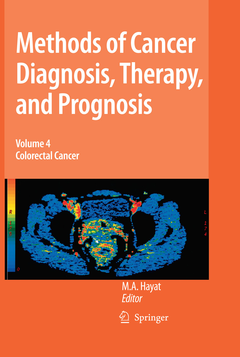 Methods of Cancer Diagnosis, Therapy and Prognosis