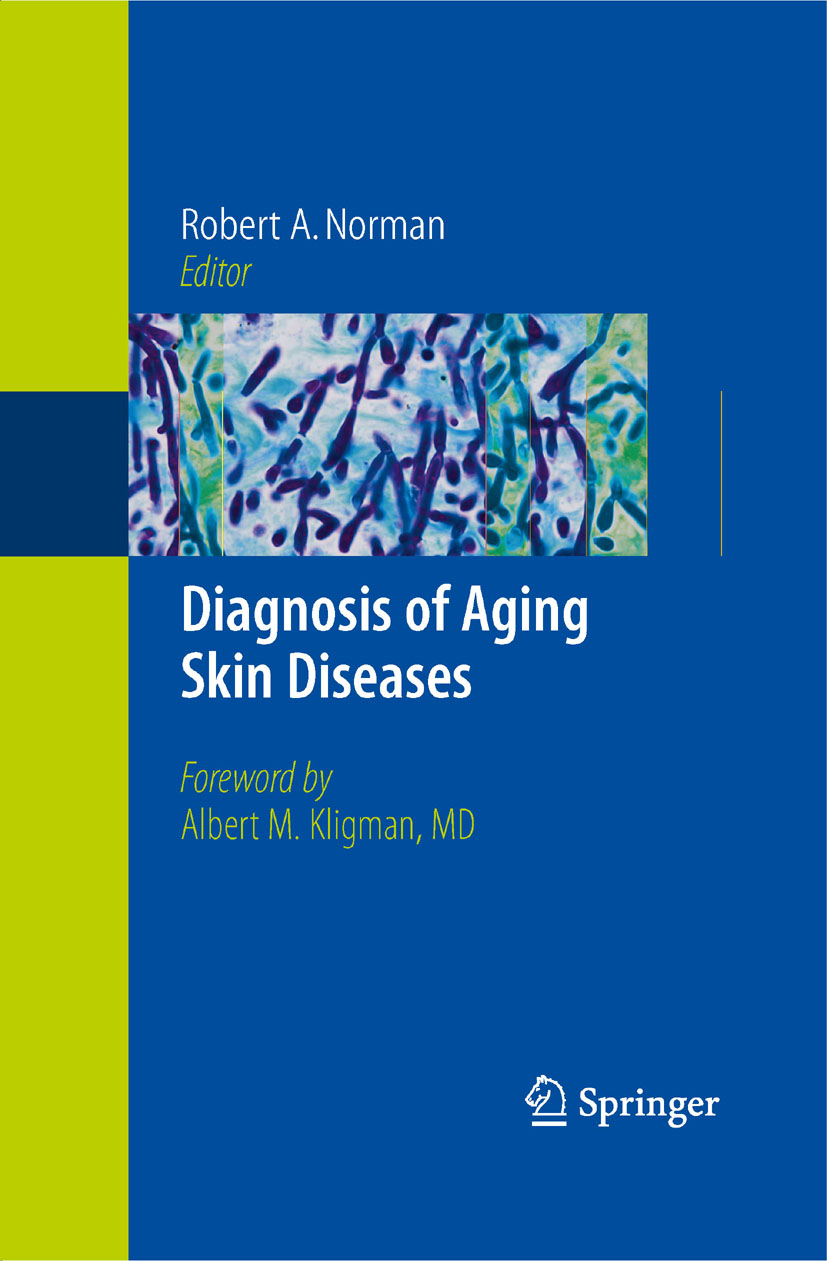 Diagnosis of Aging Skin Diseases