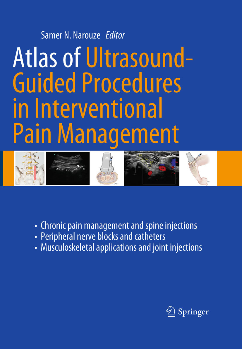 Cover Atlas of Ultrasound-Guided Procedures in Interventional Pain Management