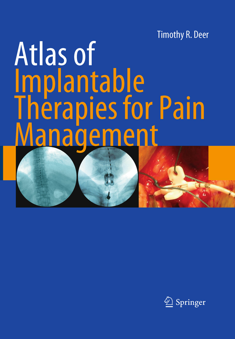 Cover Atlas of Implantable Therapies for Pain Management