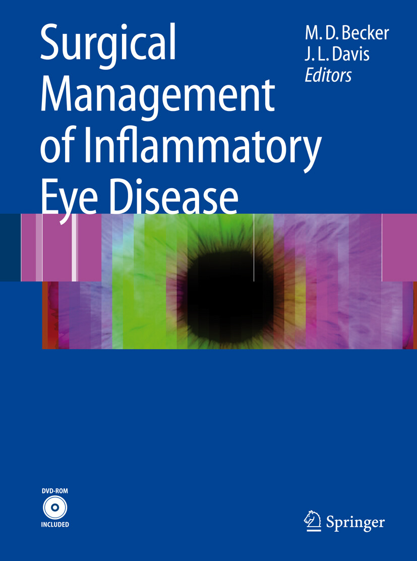 Cover Surgical Management of Inflammatory Eye Disease