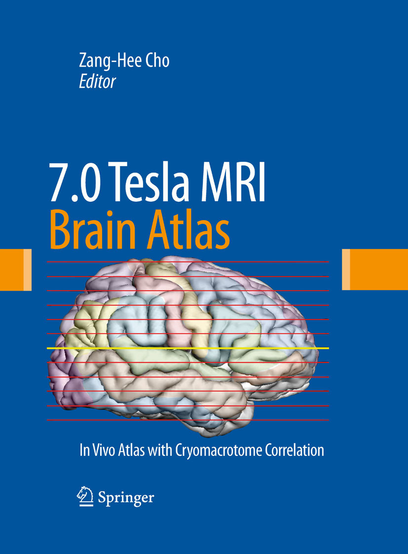Cover 7.0 Tesla MRI Brain Atlas