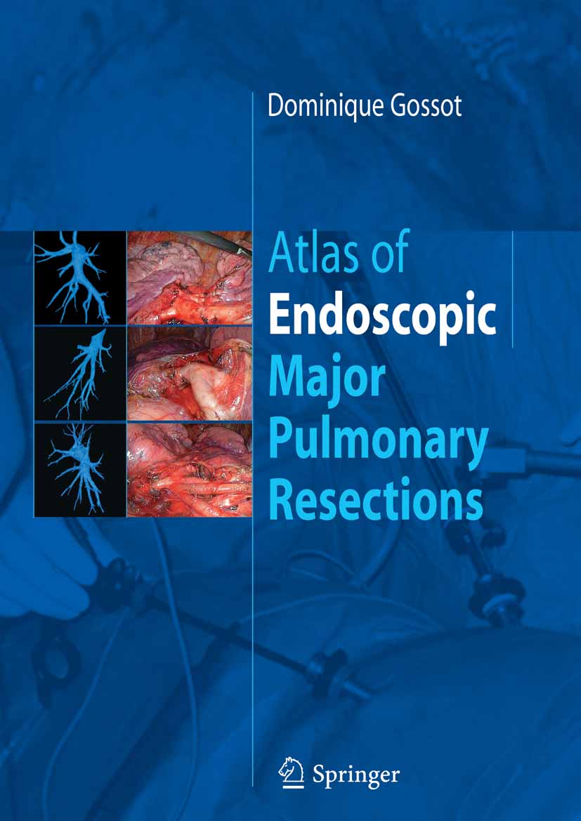 Cover Atlas of endoscopic major pulmonary resections