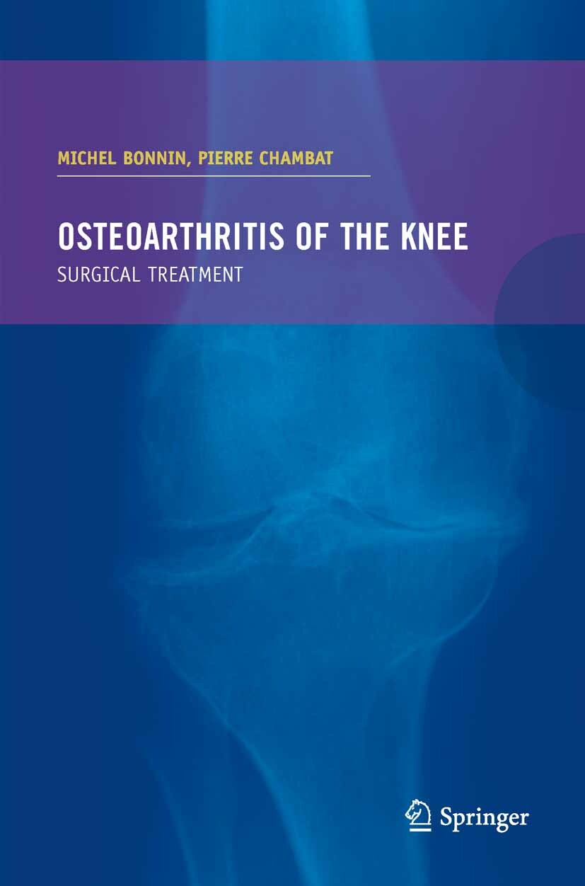Cover Osteoarthritis of the knee