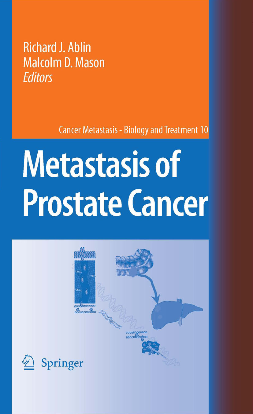 Cover Metastasis of Prostate Cancer