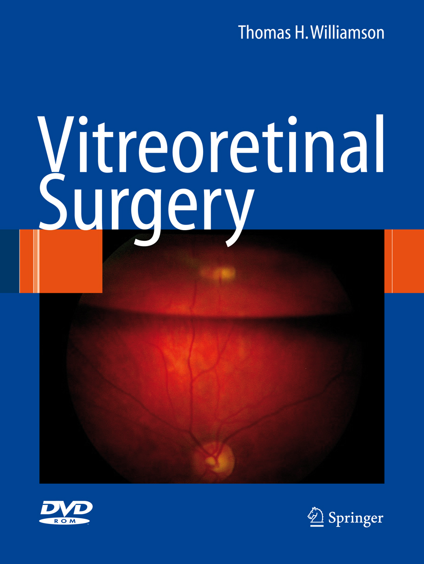 Cover Vitreoretinal Surgery