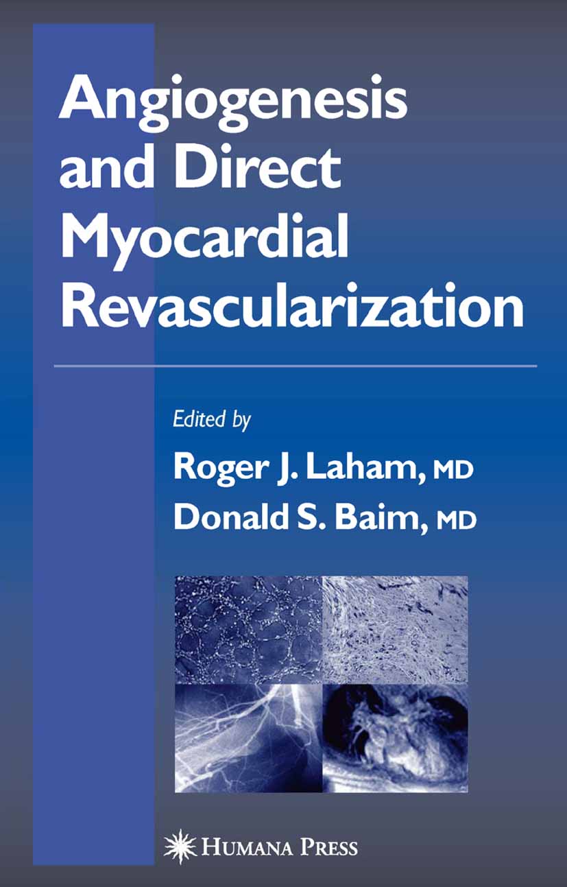 Cover Angiogenesis and Direct Myocardial Revascularization