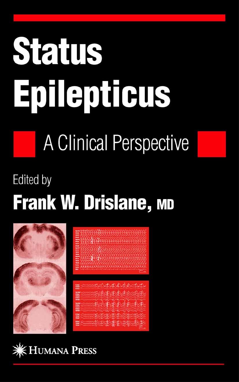 Cover Status Epilepticus