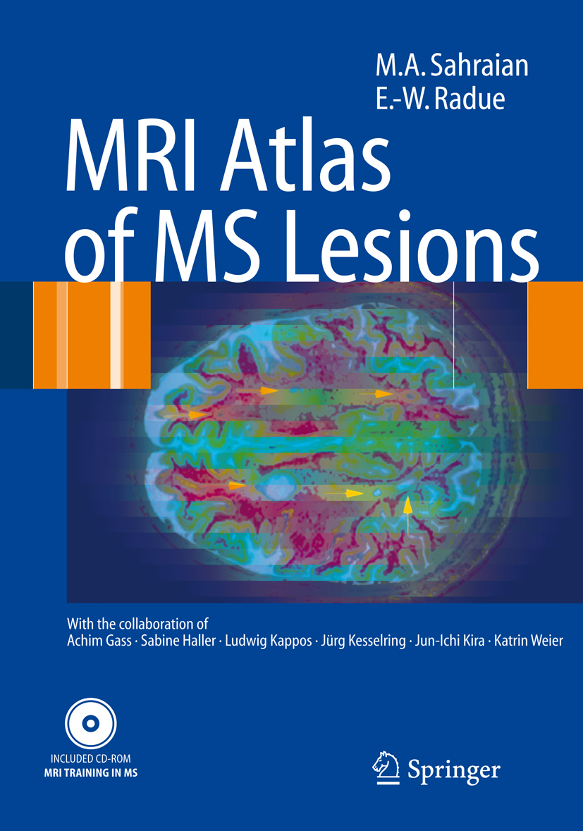 Cover MRI Atlas of MS Lesions