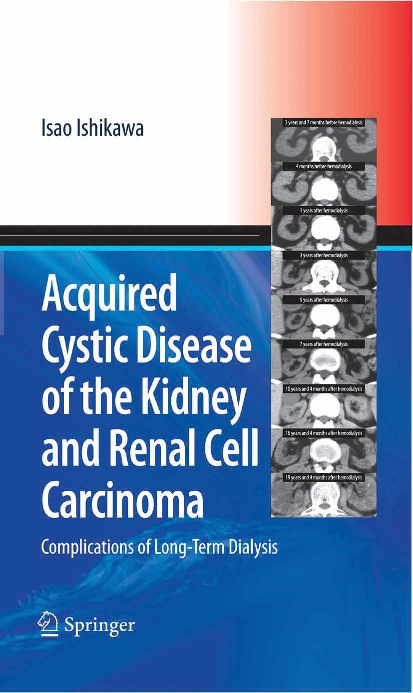 Cover Acquired Cystic Disease of the Kidney and Renal Cell Carcinoma