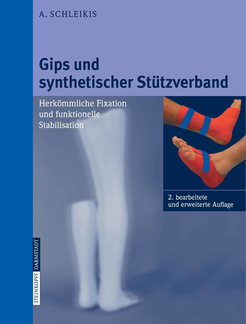 Cover Gips und synthetischer Stützverband
