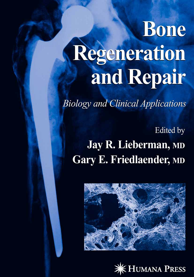 Bone Regeneration and Repair