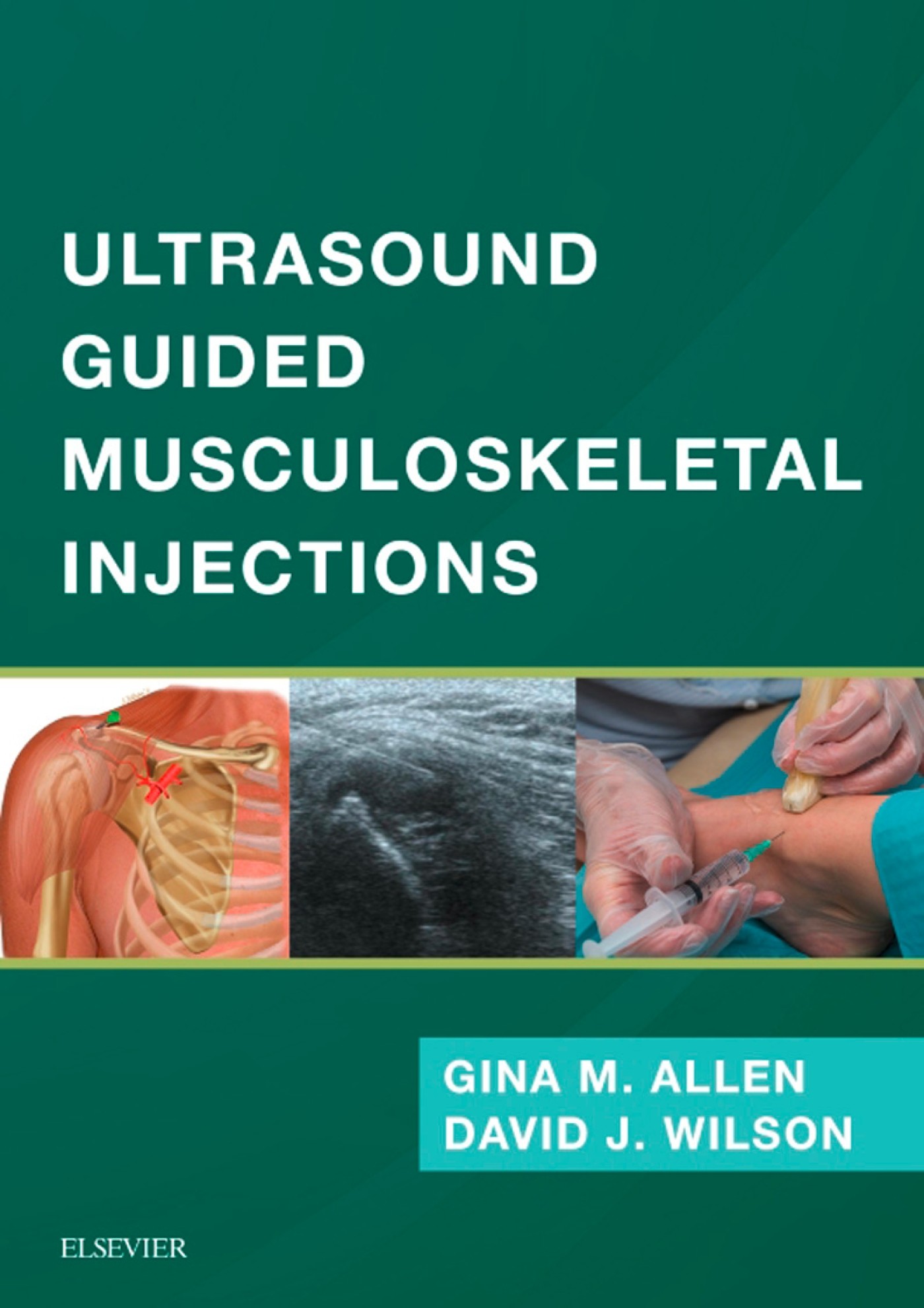 Ultrasound Guided Musculoskeletal Injections E-Book - E-Book