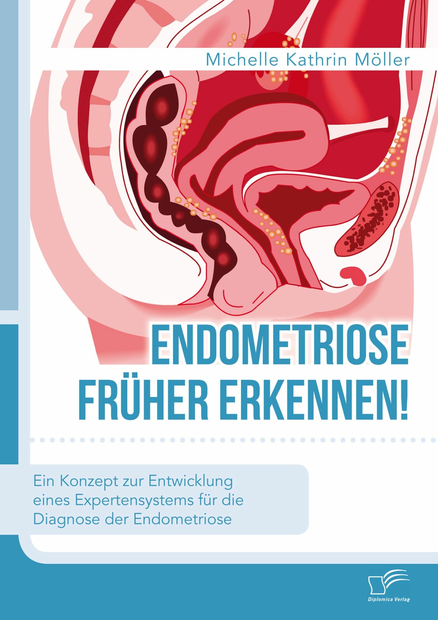 Cover Endometriose früher erkennen! Ein Konzept zur Entwicklung eines Expertensystems für die Diagnose der Endometriose