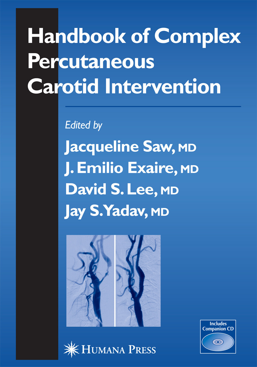 Handbook of Complex Percutaneous Carotid Intervention