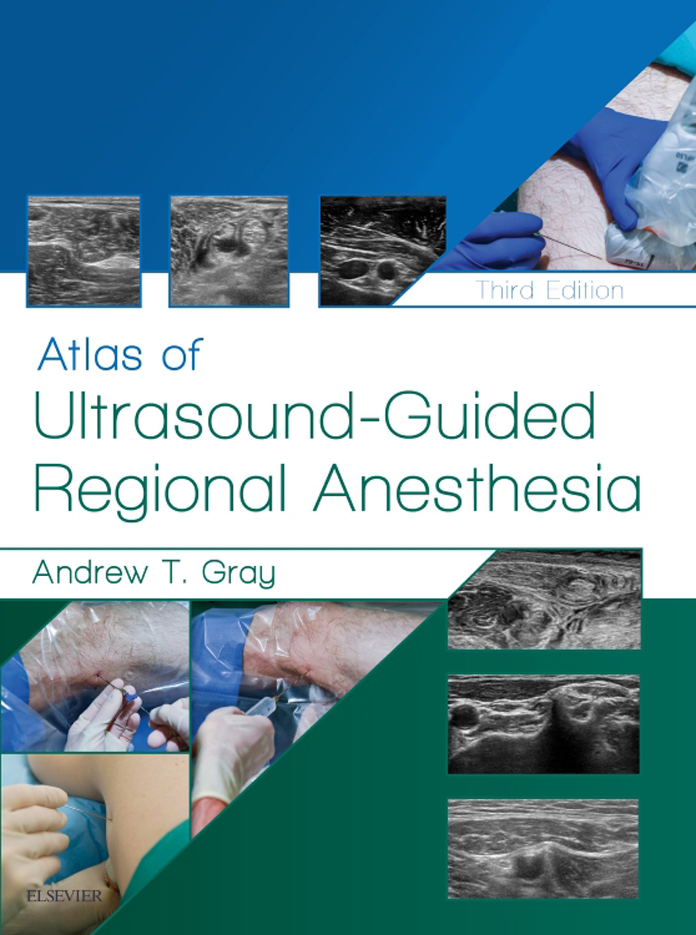 Atlas of Ultrasound-Guided Regional Anesthesia E-Book