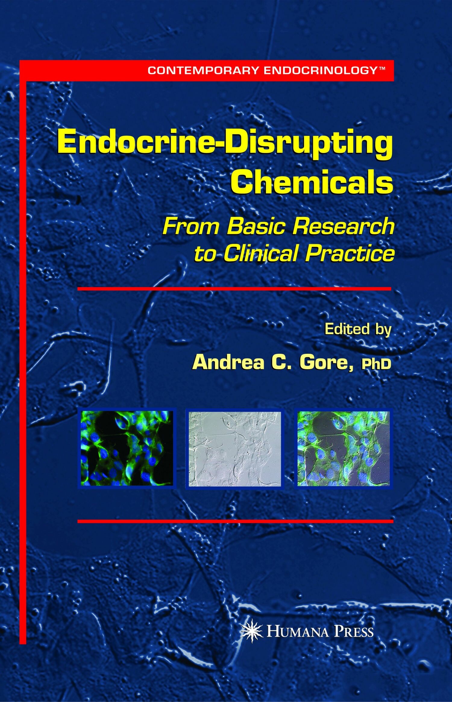 Cover Endocrine-Disrupting Chemicals