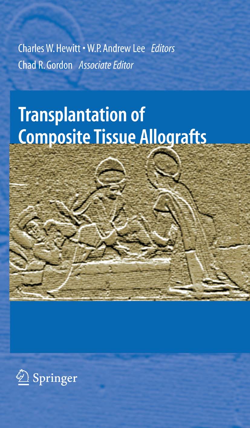 Transplantation of Composite Tissue Allografts