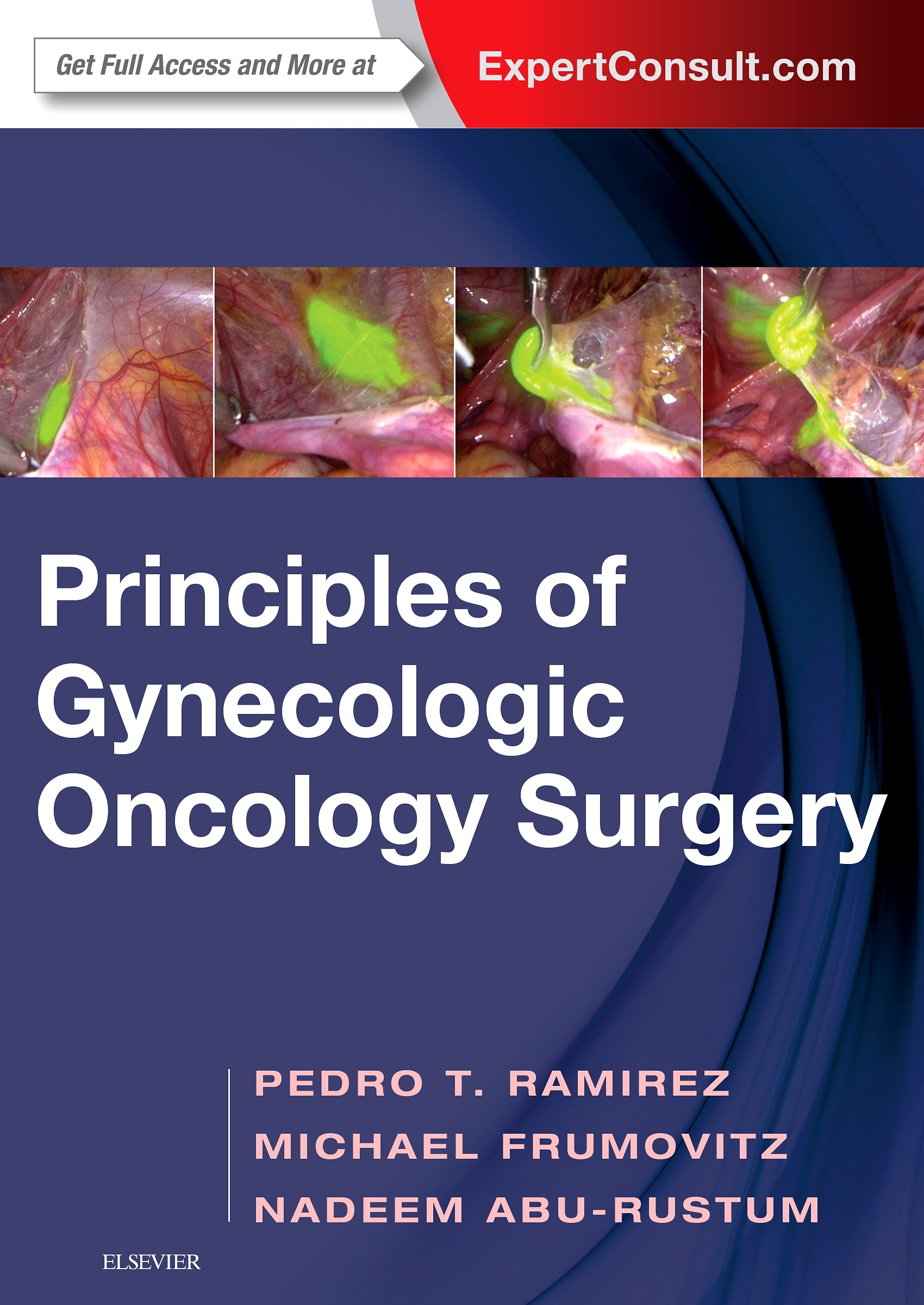 Principles of Gynecologic Oncology Surgery E-Book