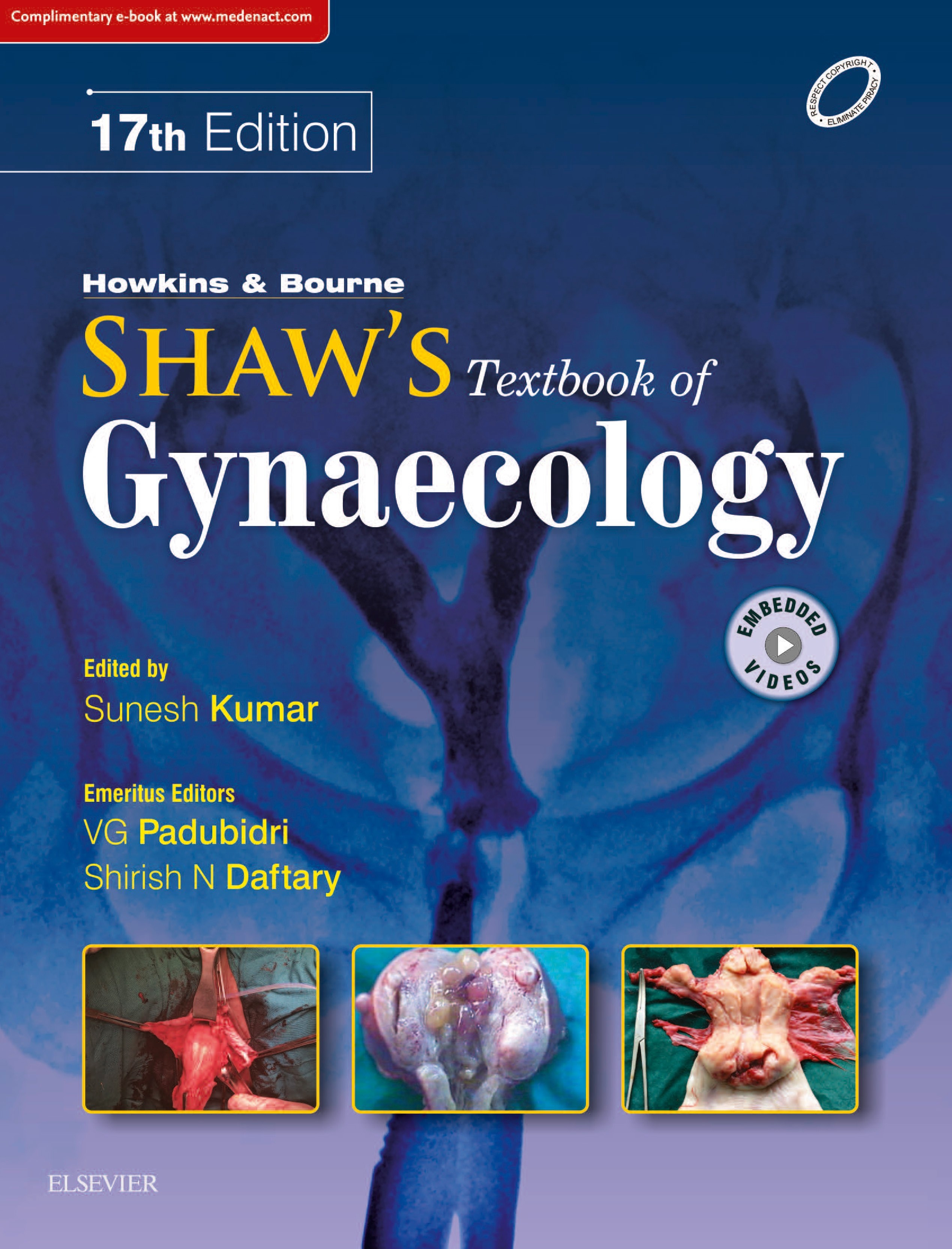 Shaw's Textbook of Gynecology-EBOOK