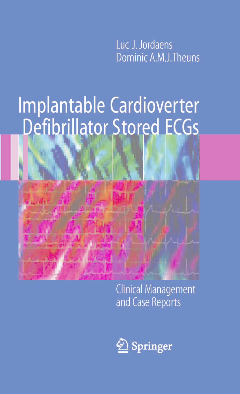 Cover Implantable Cardioverter Defibrillator Stored ECGs