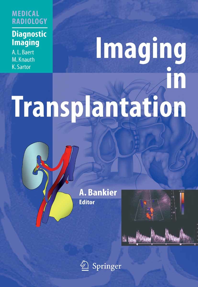 Cover Imaging in Transplantation