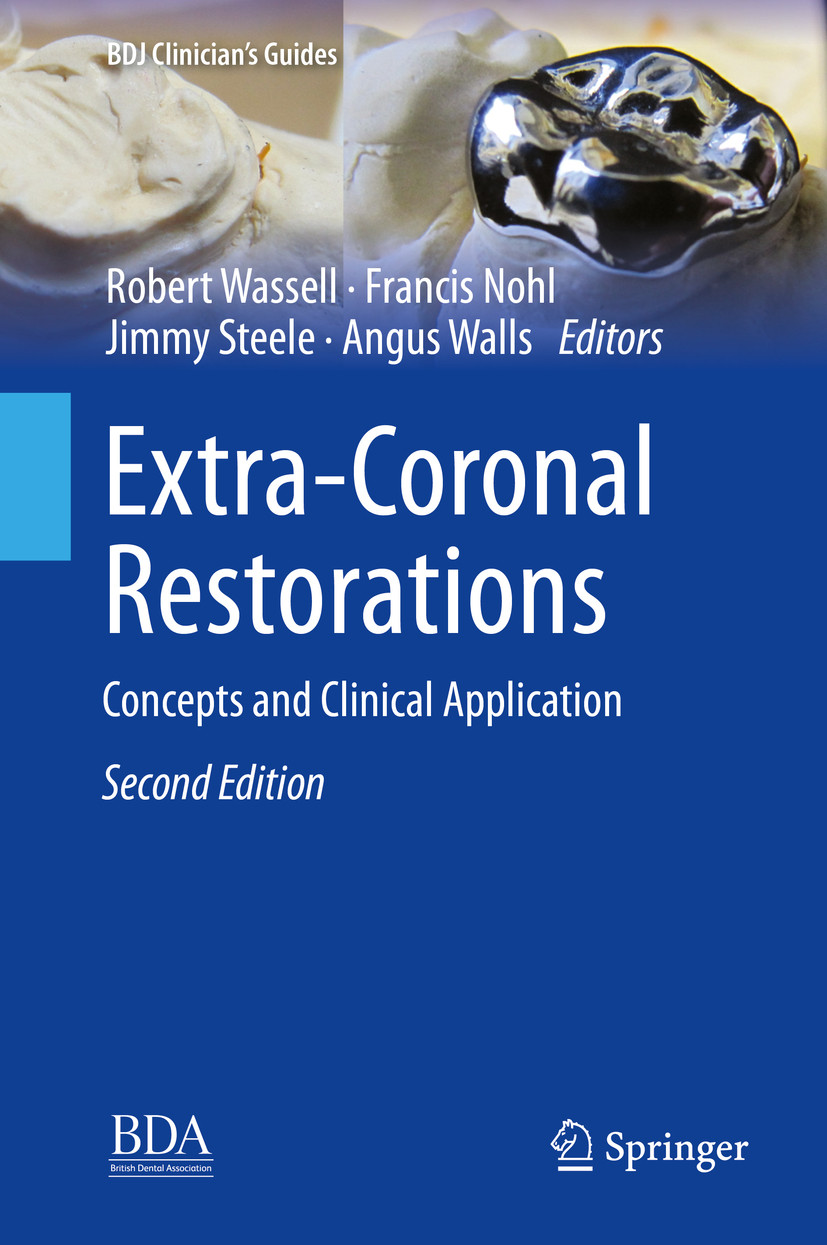 Cover Extra-Coronal Restorations