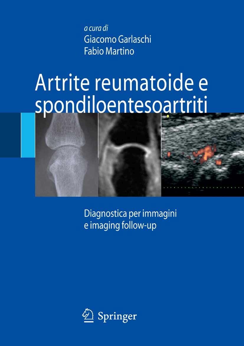 Cover Artrite reumatoide e spondiloentesoartriti