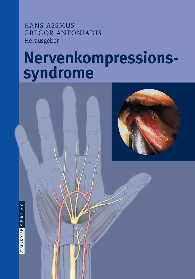 Cover Nervenkompressionssyndrome