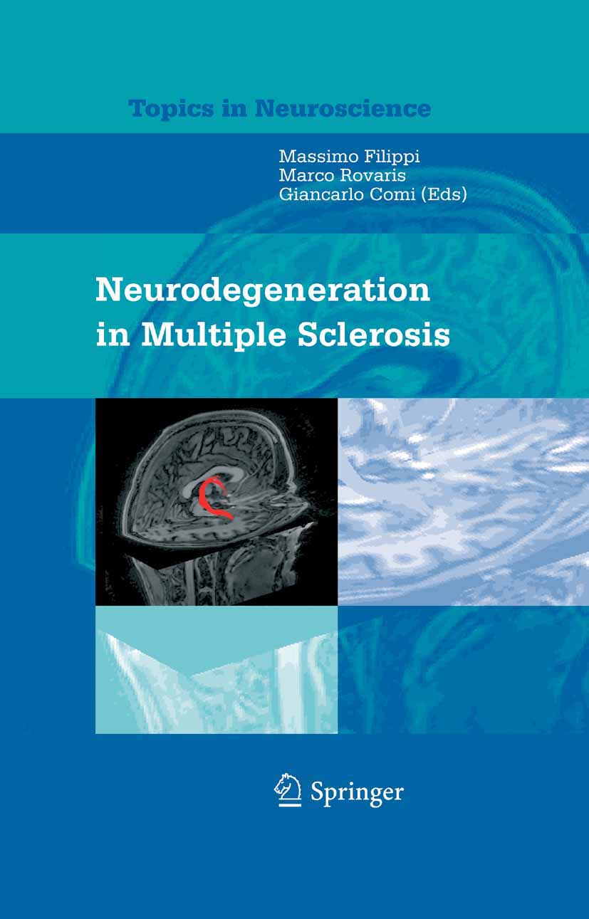 Cover Neurodegeneration in Multiple Sclerosis