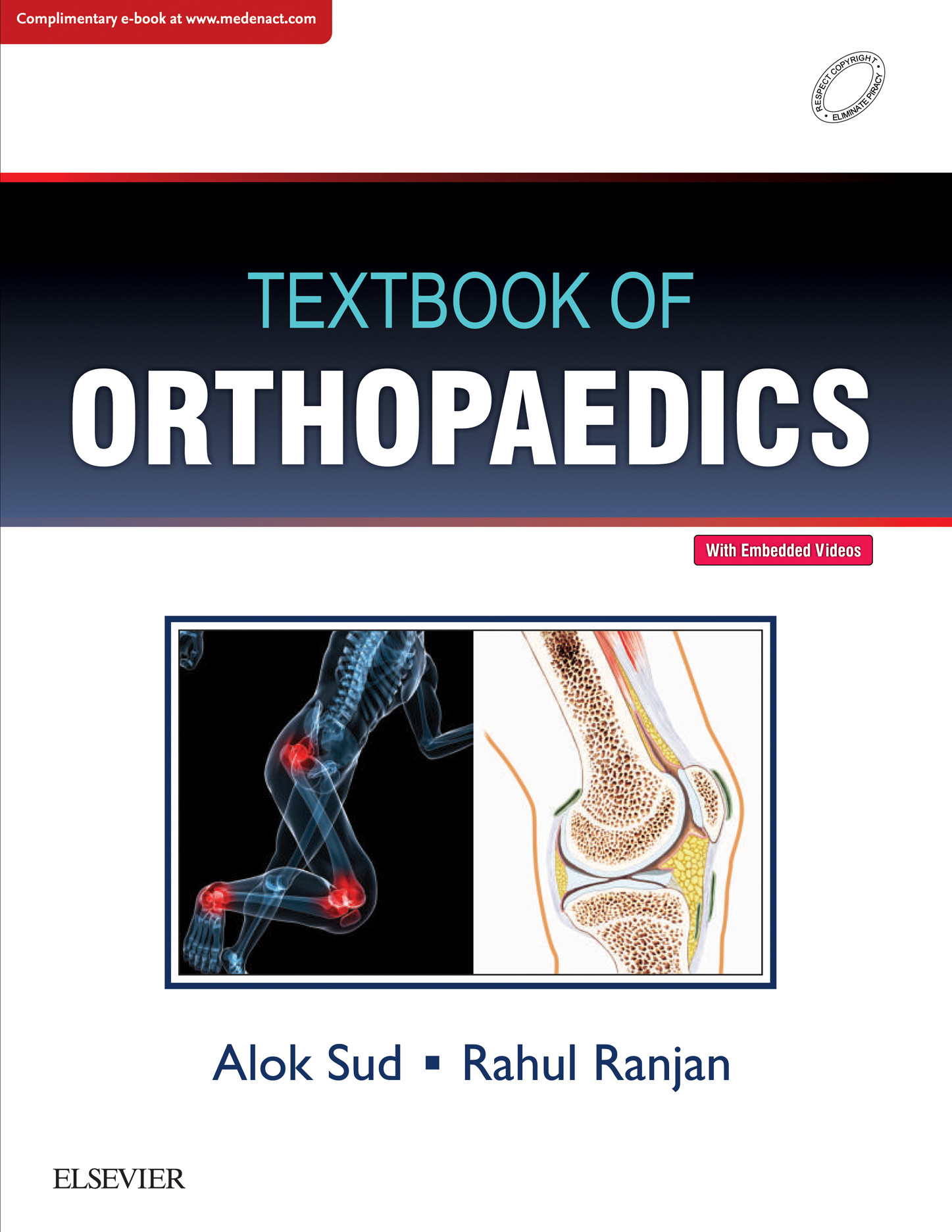 Textbook of Orthopaedics, 1e - E-Book