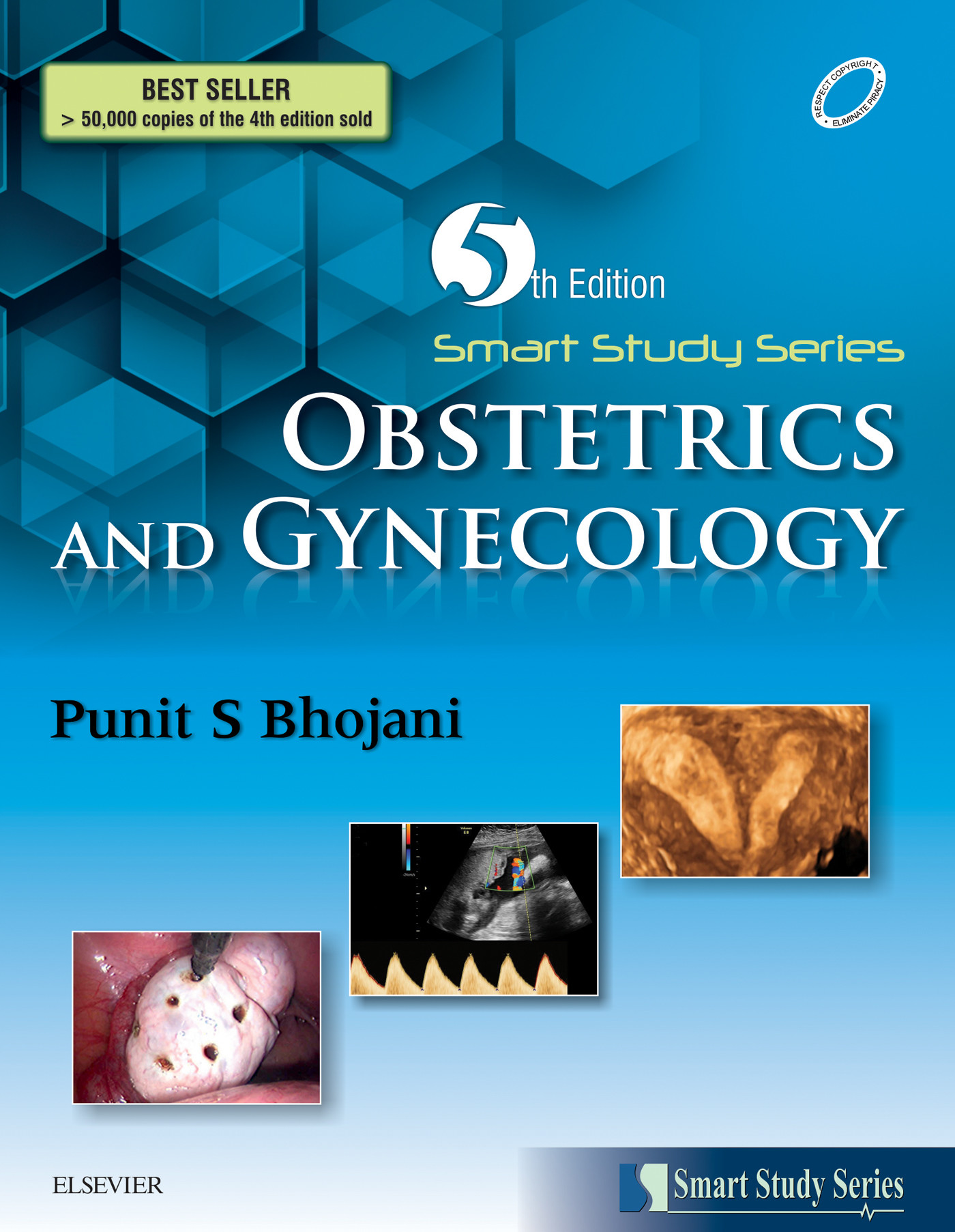 Cover Smart Study Series:Obstetrics & Gynecology - E-book