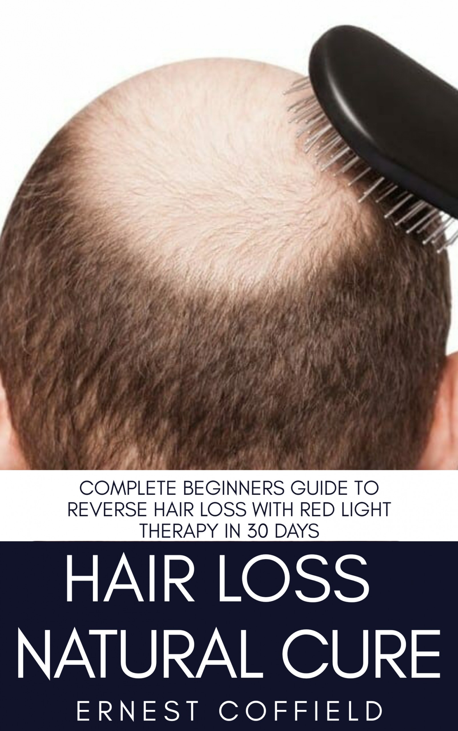 Cover Hair Loss Natural Cure