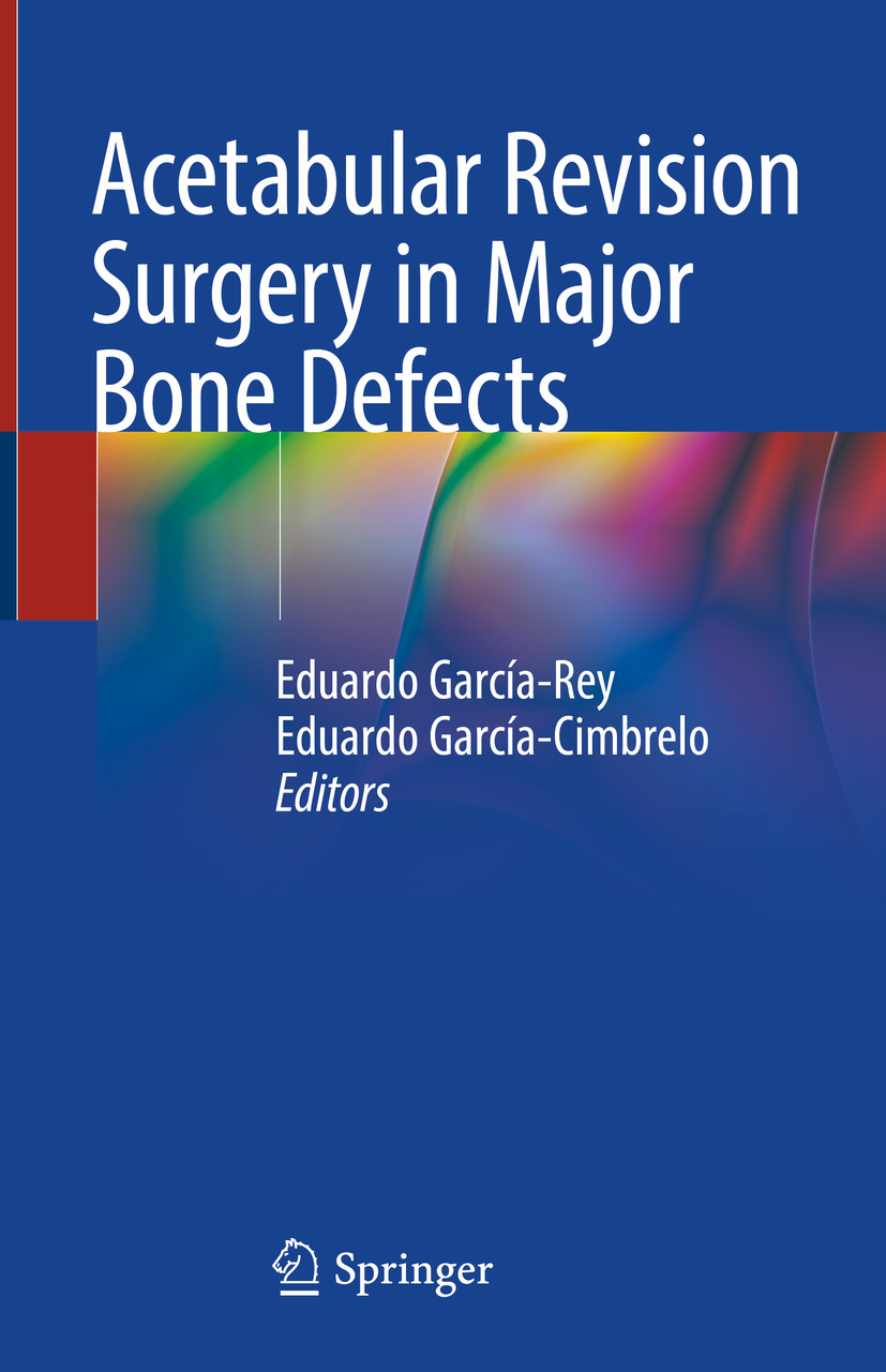Cover Acetabular Revision Surgery in Major Bone Defects