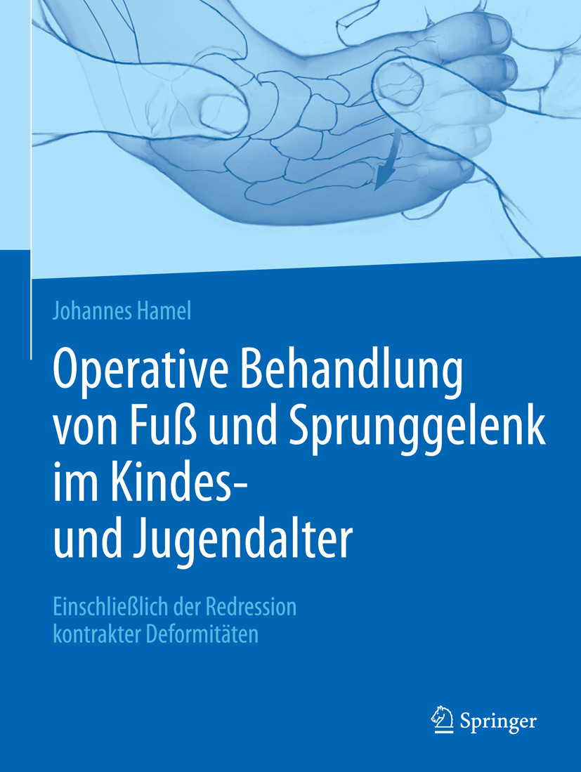 Operative Behandlung Von Fuß Und Sprunggelenk Im Kindes- Und ...