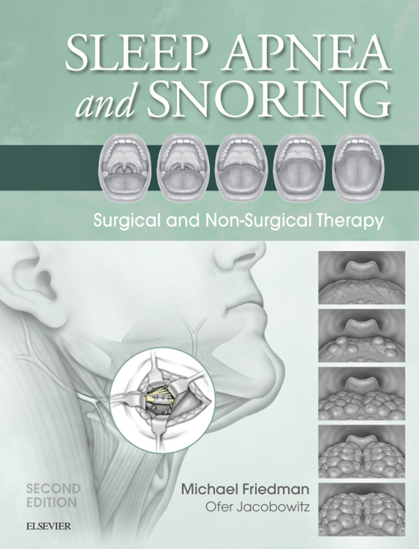 Cover Sleep Apnea and Snoring E-Book