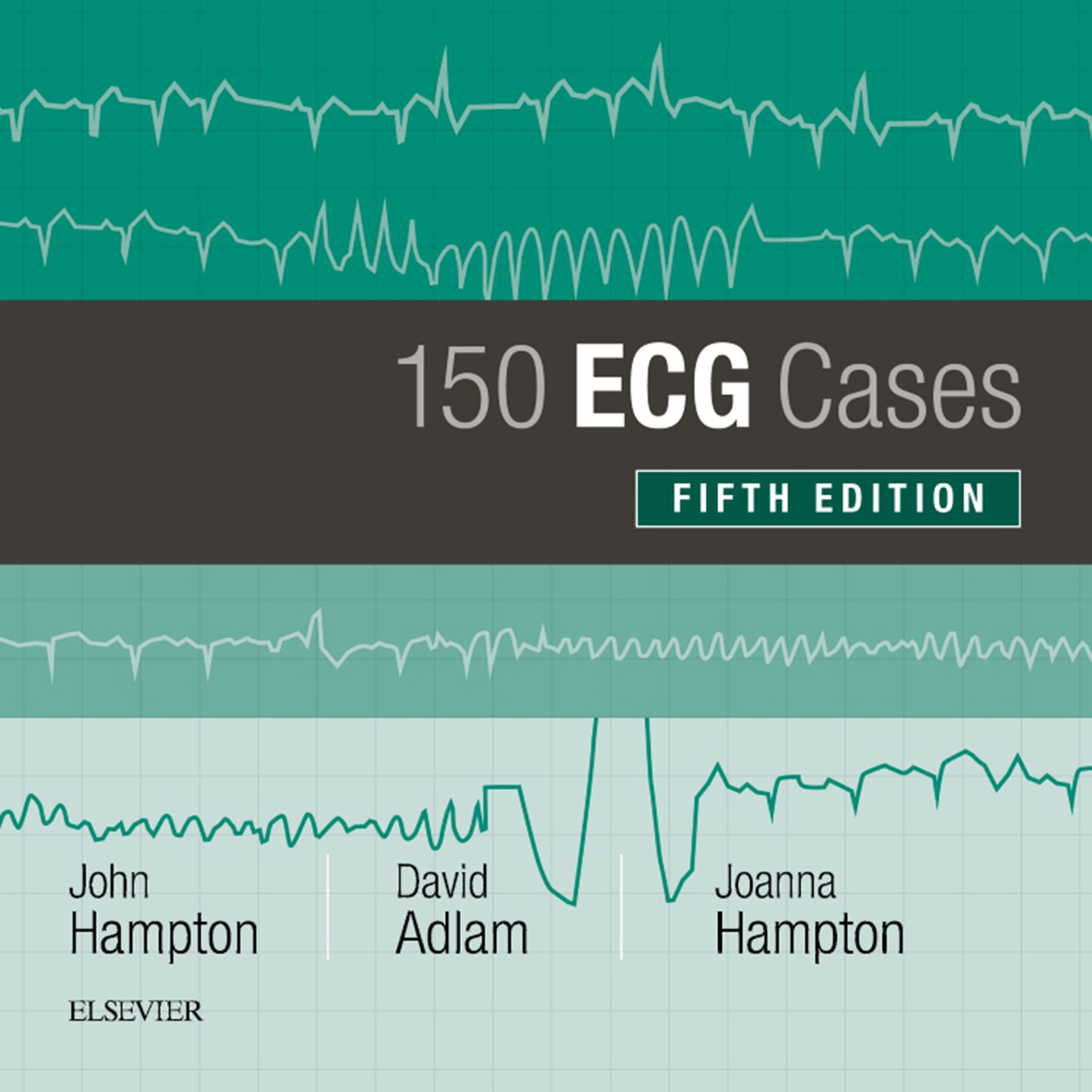 150 ECG Cases - E-Book - Frohberg