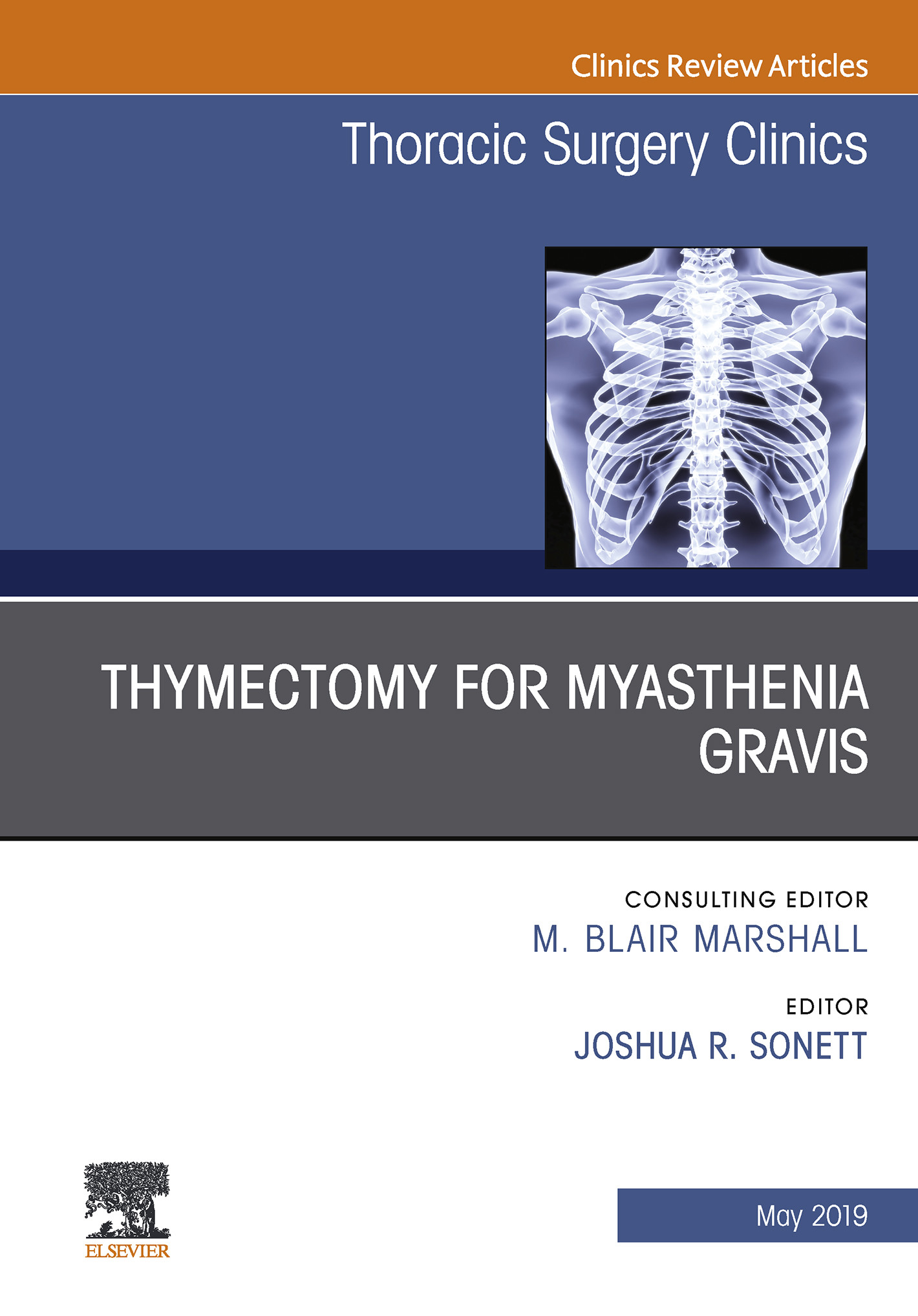 Cover Thymectomy in Myasthenia Gravis, An Issue of Thoracic Surgery Clinics, Ebook